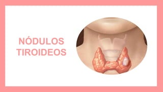 NÓDULOS
TIROIDEOS
 