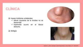 CLÍNICA
 masas indoloras unilaterales
 lóbulo izquierdo de la tiroides no se
desarrolla
 hipertrofia ocurre en el lóbulo
derecho.
 disfagia
Gardner D.. (2012). Greenspan. endocrinología básica y clínica. México, D.F.: McGrawHill.
 