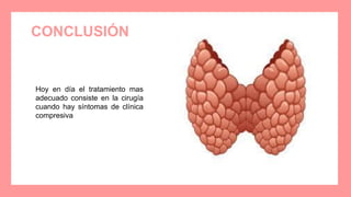 CONCLUSIÓN
Hoy en día el tratamiento mas
adecuado consiste en la cirugía
cuando hay síntomas de clínica
compresiva
 