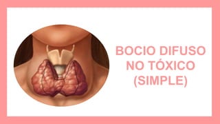 BOCIO DIFUSO
NO TÓXICO
(SIMPLE)
 