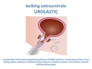 bulking extrauretrale
UROLASTIC
vinyldimethyl terminated polydimethylsiloxane (PDMS) polymer, tetrapropoxysilane cross-
linking agent, platinum vinyltetramethyl siloxane complex catalyst, and titanium dioxide
radiopacifying agent
 