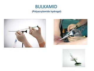 (Polyacrylamide hydrogel)
 