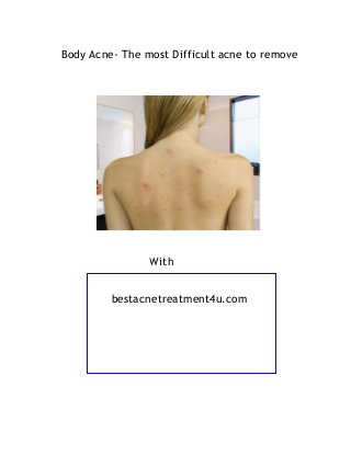 Body Acne- The most Difficult acne to remove
With
bestacnetreatment4u.com
 