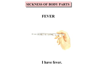 I have fever.
SICKNESS OF BODY PARTSSICKNESS OF BODY PARTS
FEVER
 