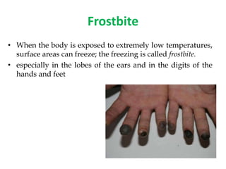 Frostbite
• When the body is exposed to extremely low temperatures,
surface areas can freeze; the freezing is called frostbite.
• especially in the lobes of the ears and in the digits of the
hands and feet
 