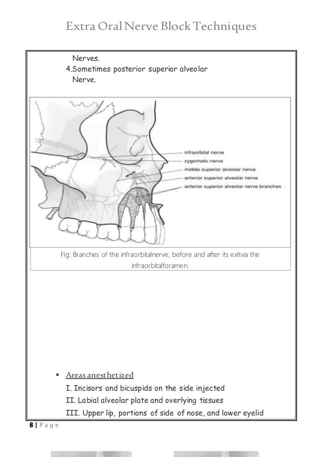ExtraOral Nerve Block Techniques