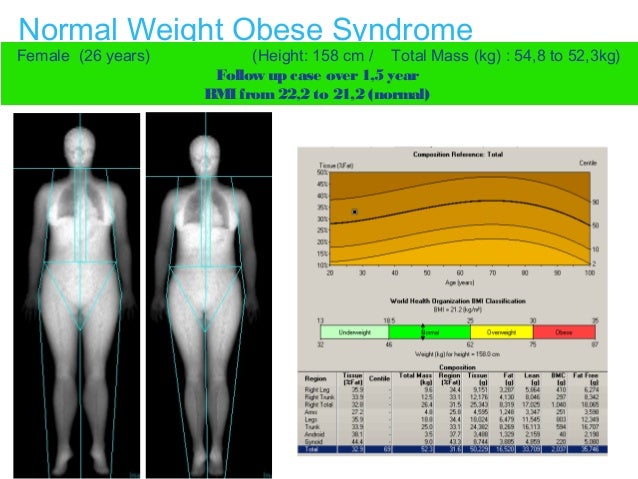 Body Composition Technology