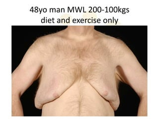 48yo man MWL 200-100kgs
   diet and exercise only
 