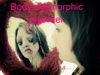 Body dysmorphic disorder 