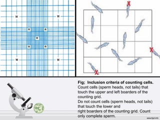 Fig; Inclusion criteria of counting cells. 
Count cells (sperm heads, not tails) that 
touch the upper and left boarders of the 
counting grid. 
Do not count cells (sperm heads, not tails) 
that touch the lower and 
right boarders of the counting grid. Count 
only complete sperm. 
 