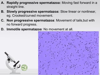 A. Rapidly progressive spermatazoa: Moving fast forward in a 
straight line. 
B. Slowly progressive spermatazoa: Slow linear or nonlinear, 
eg. Crooked/curved movement. 
C. Non progressive spermatazoa: Movement of tails,but with 
no forward progress. 
D. Immotile spermatazoa: No movement at all. 
 