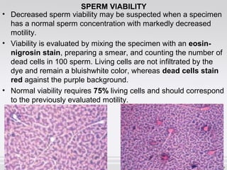 SPERM VIABILITY 
• Decreased sperm viability may be suspected when a specimen 
has a normal sperm concentration with markedly decreased 
motility. 
• Viability is evaluated by mixing the specimen with an eosin-nigrosin 
stain, preparing a smear, and counting the number of 
dead cells in 100 sperm. Living cells are not infiltrated by the 
dye and remain a bluishwhite color, whereas dead cells stain 
red against the purple background. 
• Normal viability requires 75% living cells and should correspond 
to the previously evaluated motility. 
 