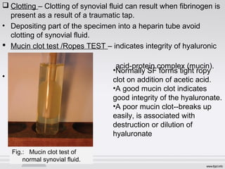  Clotting – Clotting of synovial fluid can result when fibrinogen is 
present as a result of a traumatic tap. 
• Depositing part of the specimen into a heparin tube avoid 
clotting of synovial fluid. 
 Mucin clot test /Ropes TEST – indicates integrity of hyaluronic 
acid-protein complex (mucin). 
• . 
•Normally SF forms tight ropy 
clot on addition of acetic acid. 
•A good mucin clot indicates 
good integrity of the hyaluronate. 
•A poor mucin clot--breaks up 
easily, is associated with 
destruction or dilution of 
hyaluronate 
Fig.: Mucin clot test of 
normal synovial fluid. 
 