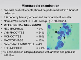 Microscopic examination 
• Synovial fluid cell counts,should be performed within 1 hour of 
collection. 
• It is done by hemacytometer and automated cell counter. 
• Normal WBC count = < 200 cells/μL (0-150 cells/μL 
 DIFFERENTIAL CELL COUNT- 
• NEUTROPHILS = 7% 
• LYMPHOCYTES = 24% 
• MONOCYTES = 48% 
• MACROPHAGE = 10% 
• SYNOVIAL LINING CELL = 4% 
• EOSINOPHILS = > 2% 
( ↑ed eosinophils in allergic diseases with arthritis and parasitic 
arthritis) 
 