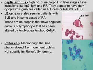 • Septic arthritis - high no. of neutrophil. In later stages have 
inclusions like IgG, IgM and RF. They appear to have dark 
cytoplasmic granules called as RA cells or RAGOCYTES. 
• LE cells -are also seen in patients with 
SLE and in some cases of RA. 
These are neutrophils that have engulfed 
nucleus of lymphocyte that has been 
altered by AntiNuclearAntibody(ANA). 
• Reiter cell- Macrophage that has 
phagocytosed 1 or more neutrophils. 
Not specific for Reiter’s Syndrome. 
LE cell 
 