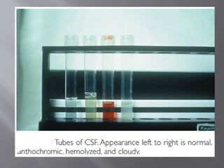 Comprehensive Guide to Cerebrospinal Fluid (CSF) Analysis in Clinical ...