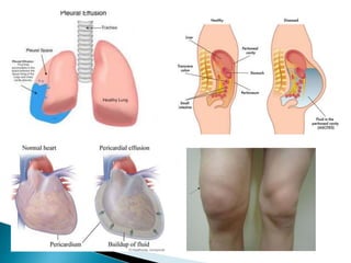 Body fluid distribution on normal aduly.pptx