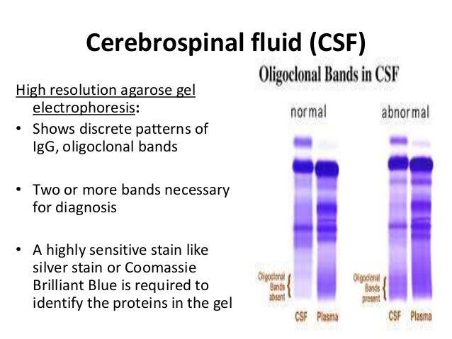 cerebrospinal is how produced fluid Body fluids cerebrospinal is how produced fluid Body fluids
