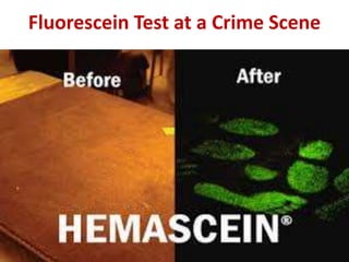 Fluorescein Test at a Crime Scene
 
