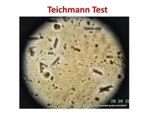 Teichmann Test
 