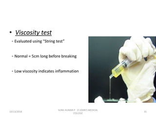 • Viscosity test
- Evaluated using “String test”
- Normal = 5cm long before breaking
- Low viscosity indicates inflammation
10/13/2018 31
SUNIL KUMAR.P ST.JOHN'S MEDICAL
COLLEGE
 