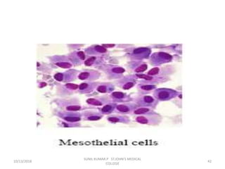 10/13/2018 42
SUNIL KUMAR.P ST.JOHN'S MEDICAL
COLLEGE
 