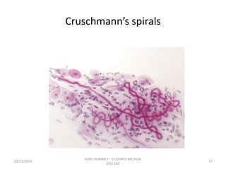 Cruschmann’s spirals
10/13/2018 57
SUNIL KUMAR.P ST.JOHN'S MEDICAL
COLLEGE
 