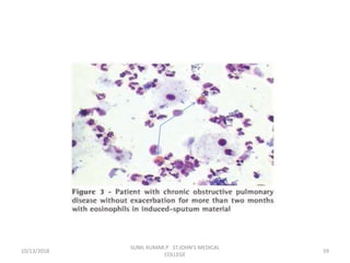 10/13/2018 59
SUNIL KUMAR.P ST.JOHN'S MEDICAL
COLLEGE
 