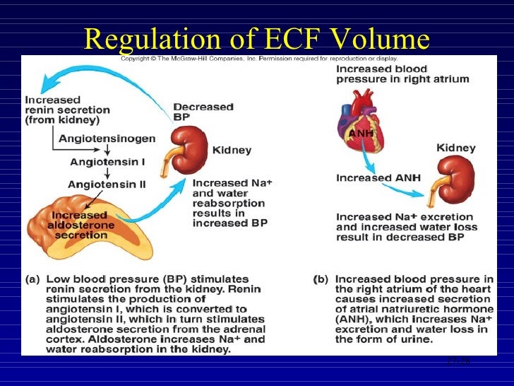 extracellular fluid volume excess extracellular fluid volume excess