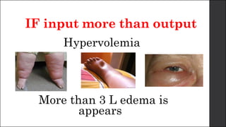 IF input more than output
Hypervolemia
More than 3 L edema is
appears
 