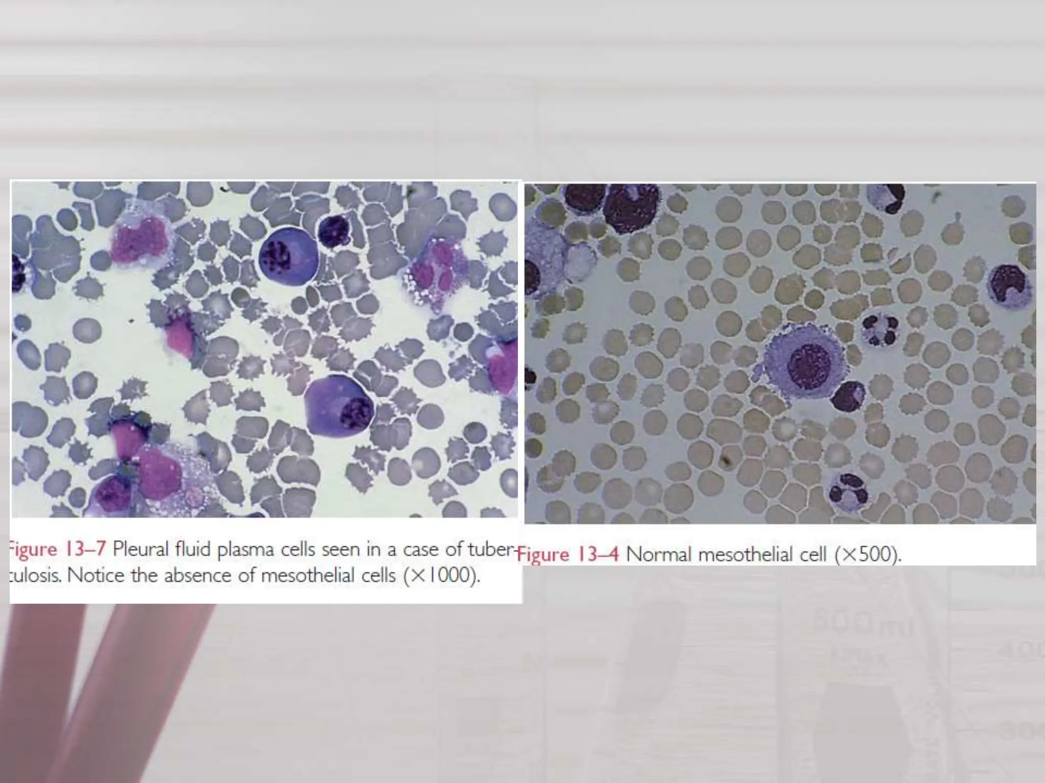 Sputum Rheology BODY FLUIDS AND SPUTUM ANALYSIS.pptx for mbbs and para medical | PPTX