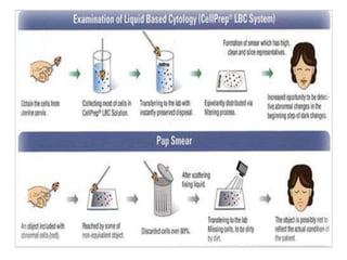Isbod Pap Body fluids, cervical pap | PPTX