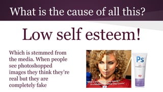 What is the cause of all this?
Low self esteem!
Which is stemmed from
the media. When people
see photoshopped
images they think they’re
real but they are
completely fake
 