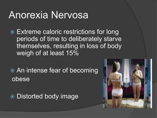 Anorexia Nervosa
 Extreme caloric restrictions for long
periods of time to deliberately starve
themselves, resulting in loss of body
weigh of at least 15%
 An intense fear of becoming
obese
 Distorted body image
 