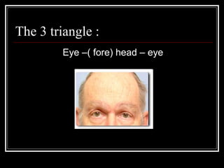 The 3 triangle :
         Eye –( fore) head – eye
 