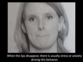 When the lips disappear, there is usually stress or anxiety
driving this behavior
 
