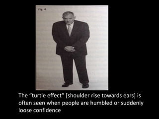 The “turtle effect” [shoulder rise towards ears] is
often seen when people are humbled or suddenly
loose confidence
 