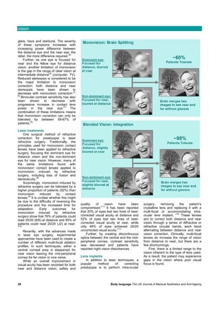 vision

glare, haze and starburst. The severity
of these symptoms increases with
increasing power difference between
the distance eye and the near eye; the
                                      (4)
older, the more difference required.
    Further, as one eye is focused for
near and the fellow eye for distance
vision, another limitation of monovision
is the gap in the range of clear vision at
                       (5)
intermediate distance (computer, TV).
Reduced stereopsis is considered to be
the major limitation to monovision
correction; both distance and near
stereopsis have been shown to
                                          (4,
decrease with monovision correction.
6)
   Binocular contrast sensitivity has also
been     shown     to decrease with
progressive increase in contact lens
                                  (7)
power in the near eye.                  The
combination of these limitations means
that monovision correction can only be
tolerated by between 59-67% of
          (5)
patients.

Laser treatments
    One surgical method of refractive
correction for presbyopia is laser
refractive surgery. Traditionally, the
principles used for monovision contact
lenses have been applied to refractive
surgery, focusing the dominant eye for
distance vision and the non-dominant
eye for near vision. However, many of
the same limitations found with
monovision contact lenses applied to
monovision induced by refractive
surgery, including loss of fusion and
              (8)
stereoacuity.
    Surprisingly, monovision induced by
refractive surgery can be tolerated by a
higher proportion of patients (92%) than
monovision        induced    by   contact
        (9)
lenses. It is unclear whether this might
be due to the difficulty of reversing the
procedure and the increased time for            quality    of    vision     have    been   surgery,     removing         the   patient’s
                                                              (11)
adaptation.       Early   outcomes     for      compromised.       It has been reported    crystalline lens and replacing it with a
monovision induced by refractive                that 20% of eyes lost two lines of best-   multi-focal or accommodating intra-
                                                                                                                    (12)
surgery show that 76% of patients could         corrected visual acuity at distance and    ocular lens implant.           These lenses
read 20/20 (6/6) at distance and 95% of         52% of eyes lost two lines of best-        aim to correct both distance and near
patients could read 20/25 (J2) at near.         corrected visual acuity at near, while     vision through a series of diffractive or
(10)                                            only 48% of eyes achieved 20/20            refractive circular bands, each band
                                                                           (11)
    Recently, with the advances made            uncorrected visual acuity.                 alternating between distance and near
in laser eye surgery, experimental                  Further, by creating discontinuous     vision correction. Clinically, multi-focal
approaches have been used to create a           optics between the central and the mid-    lenses do increase the range of vision
number of different multi-focal ablation        peripheral cornea, contrast sensitivity    from distance to near, but there are a
profiles. In such techniques, either a          was decreased and patients have            few shortcomings.
central corneal area is steepened for           reported night vision disturbances.            First, there is a limited range to the
near vision leaving the mid-peripheral                                                     vision inherent to the type of lens used.
cornea for far vision or vice versa.            Lens implants                              As a result, the patient may experience
    While an overall improvement in                In addition to laser techniques, a      gaps in the vision where poor visual
visual acuity has been recorded for both        popular    method     of    correcting     focus is found.
near and distance vision, safety and            presbyopia is to perform intra-ocular




29                                                                  Body language The UK Journal of Medical Aesthetics and Anti-Ageing
 