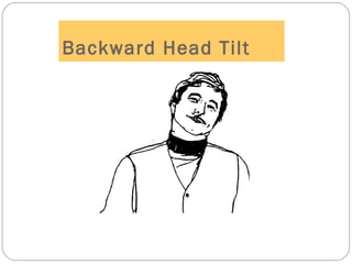 Backward Head Tilt
 