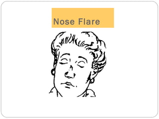 Nose Flare
 