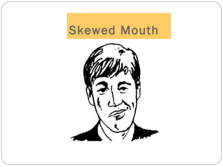 Skewed Mouth
 