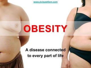 www.zivisastilom.com




OBESITY

A disease connected
 to every part of life
 