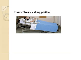Reverse Trendelenburg position
 