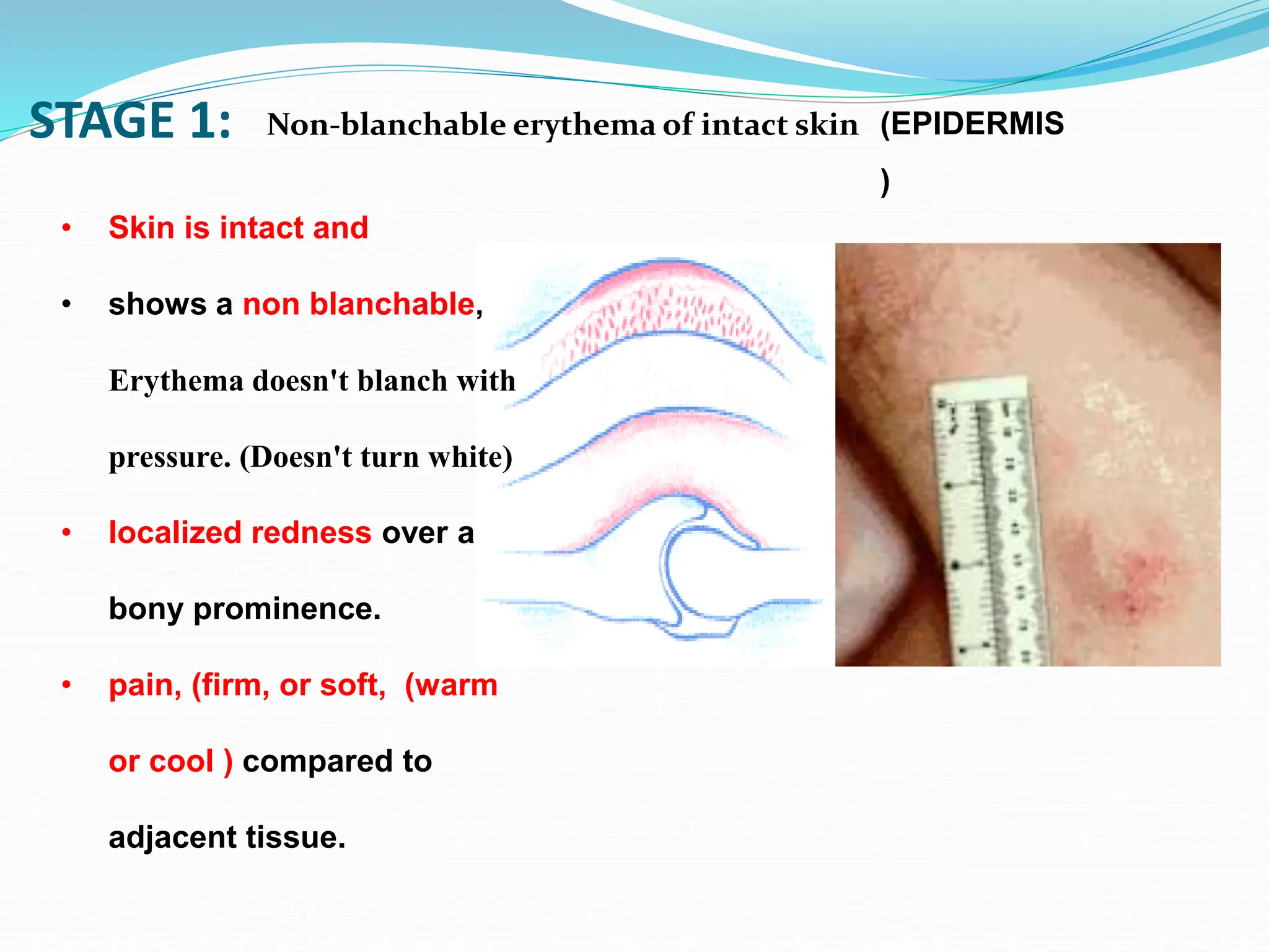 Body Mechanics, Positioning & Moving ..ppt