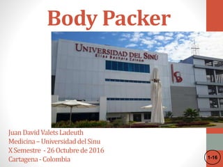 Body Packer
JuanDavidValetsLadeuth
Medicina–UniversidaddelSinu
XSemestre -26Octubrede2016
Cartagena-Colombia 1-16
 