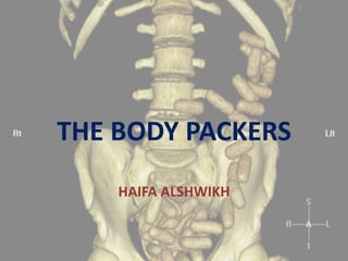 THE BODY PACKERS
HAIFA ALSHWIKH
 