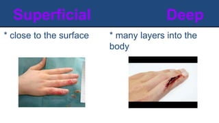 Superficial Deep
* many layers into the
body
* close to the surface
 