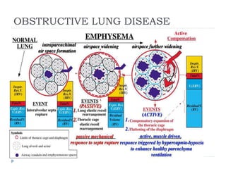 OBSTRUCTIVE LUNG DISEASE
 