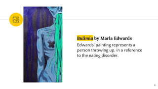 Bulimia by Marla Edwards
Edwards’ painting represents a
person throwing up, in a reference
to the eating disorder.
6
 