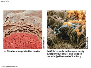 © 2016 Pearson Education, Inc.
Figure 24.2
(a) Skin forms a protective barrier. (b) Cilia on cells in the nasal cavity
sweep mucus (blue) and trapped
bacteria (yellow) out of the body.
Colorized
SEM
Colorized
SEM
 